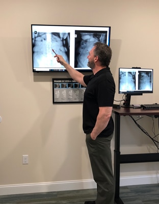 X-Ray-Consult-at-Bombery-Chiropractic.jpg